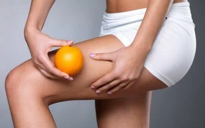 3 CLAVES PARA REDUCIR LA CELULITIS